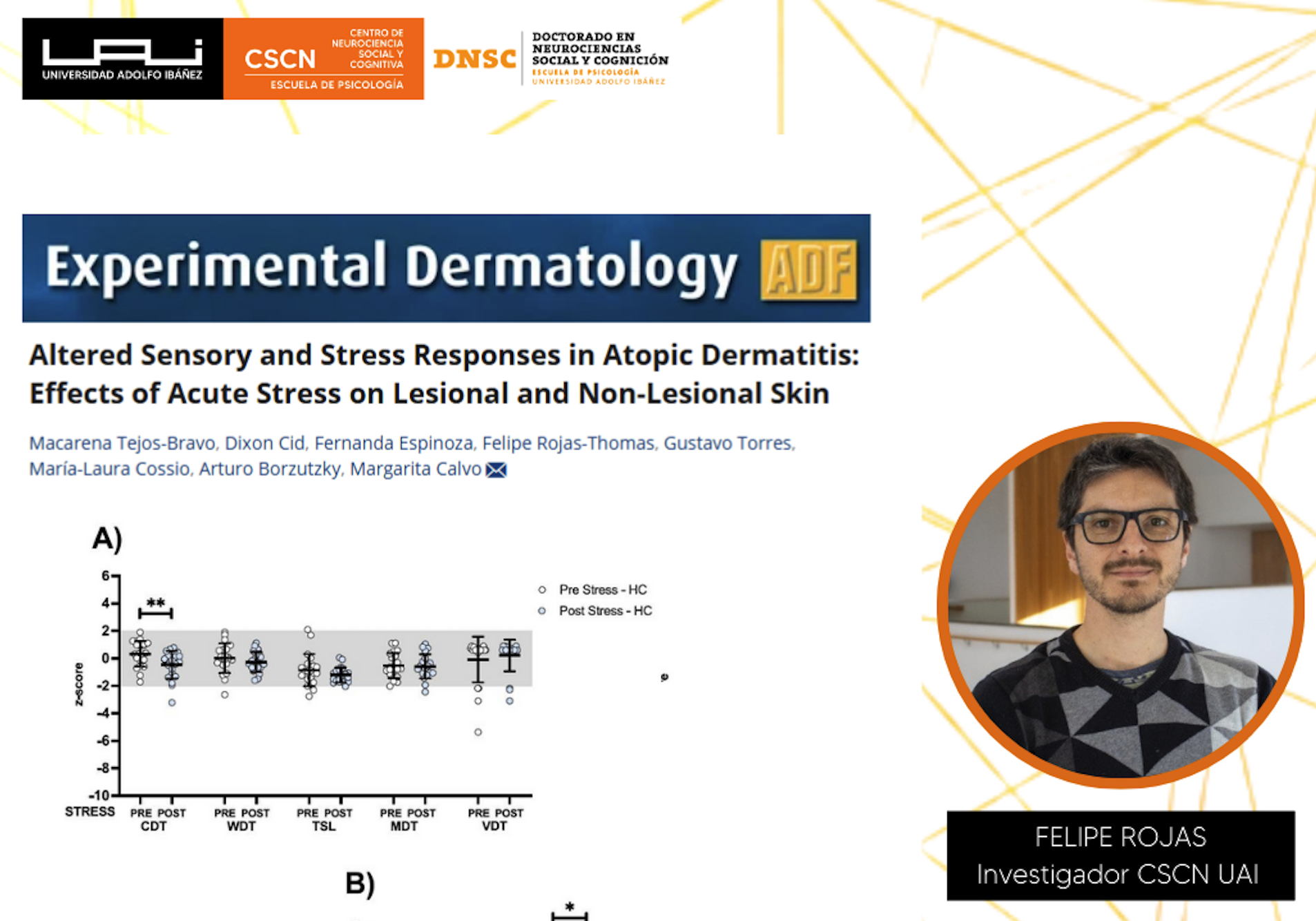 Altered Sensory and Stress Responses in Atopic Dermatitis: Effects of Acute Stress on Lesional and Non-Lesional Skin